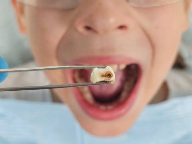 Best Pediatric Emergency Dentist in Independence, MN