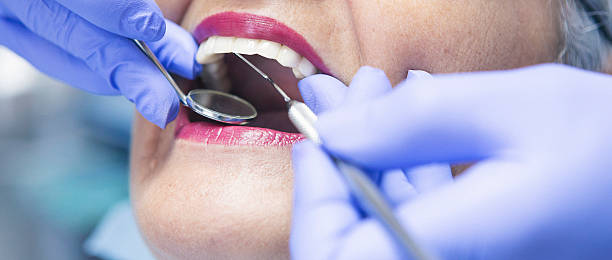 Best Emergency Tooth Extraction in Independence, MN